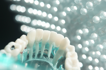 Dentists dental teeth teaching model showing each tooth, gum, root, implant, decay, plaque and enamel.の写真素材