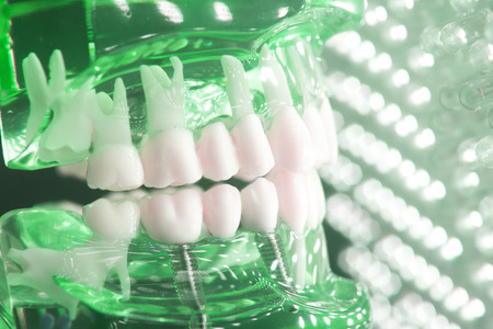 Dentists dental teeth teaching model showing each tooth, gum, root, implant, decay, plaque and...