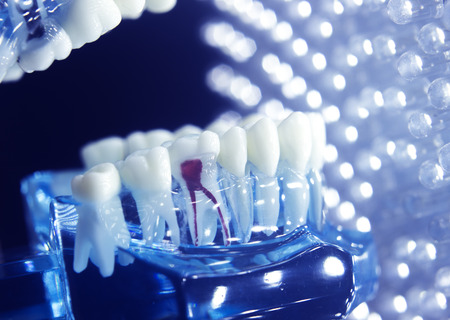 Dentists dental teeth teaching model showing each tooth, gum, root, implant, decay, plaque and enamel.の写真素材