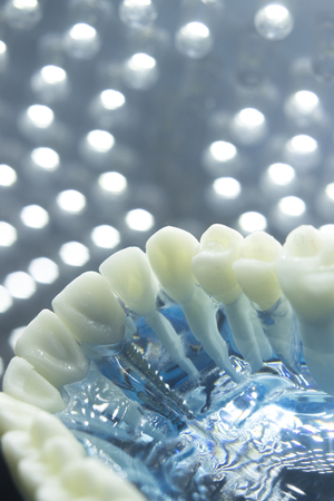 Dentists dental teeth teaching model showing each tooth, gum, root, implant, decay, plaque and...