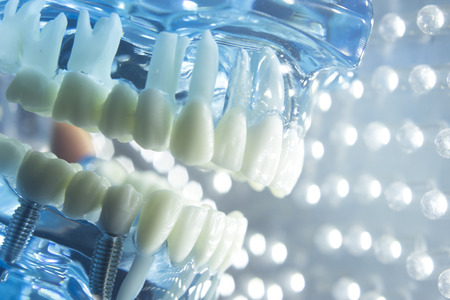 Dentists dental teeth teaching model showing each tooth, gum, root, implant, decay, plaque and...