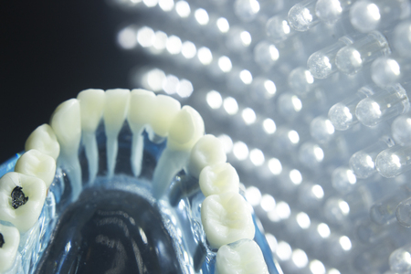Dentists dental teeth teaching model showing each tooth, gum, root, implant, decay, plaque and...