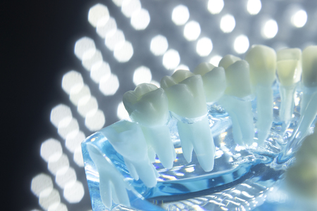 Dentists dental teeth teaching model showing each tooth, gum, root, implant, decay, plaque and enamel.の写真素材