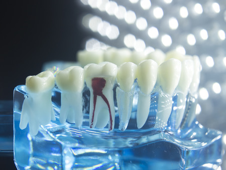 Dentists dental teeth teaching model showing each tooth, gum, root, implant, decay, plaque and enamel.の写真素材
