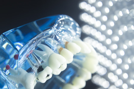 Dentists dental teeth teaching model showing each tooth, gum, root, implant, decay, plaque and...