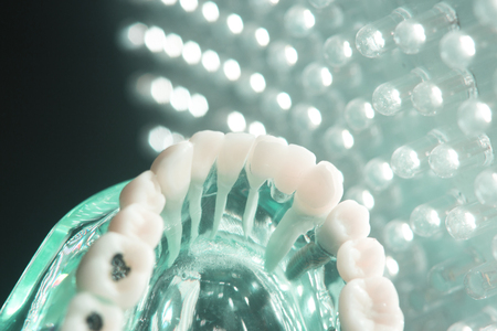 Dentists dental teeth teaching model showing each tooth, gum, root, implant, decay, plaque and...