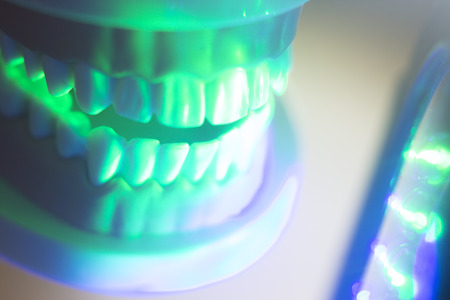 Dental teeth orthodontic dentistry teachng model with gums, tooth enamel, plaque, roots and metal...