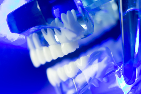 Dental teeth orthodontic dentistry teachng model with gums, tooth enamel, plaque, roots and metal...