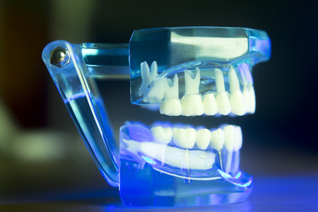 Dental teeth orthodontic dentistry teachng model with gums, tooth enamel, plaque, roots and metal...