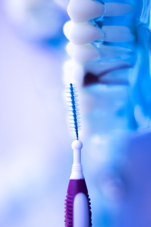 Dental teeth orthodontic dentistry teachng model with gums, tooth enamel, plaque, roots and metal implants.の写真素材