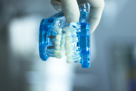 Dental teeth orthodontic dentistry teachng model with gums, tooth enamel, plaque, roots and metal...