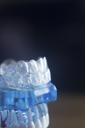 Dental teeth orthodontic dentistry teachng model with gums, tooth enamel, plaque, roots and metal...