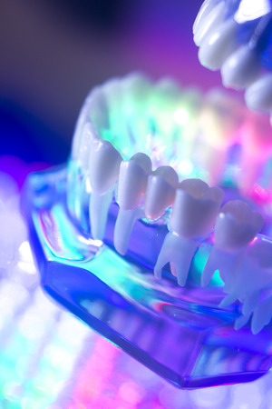 Dental teeth orthodontic dentistry teachng model with gums, tooth enamel, plaque, roots and metal implants.の写真素材
