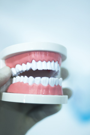 Dental teeth orthodontic dentistry teachng model with gums, tooth enamel, plaque, roots and metal implants.の写真素材