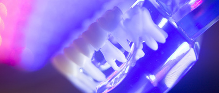 Dental teeth orthodontic dentistry teachng model with gums, tooth enamel, plaque, roots and metal...