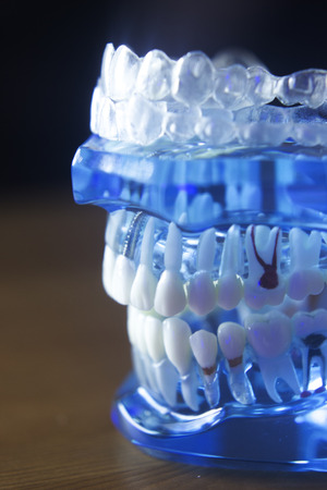 Dental teeth orthodontic dentistry teachng model with gums, tooth enamel, roots and jaw.