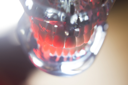 Dental teeth orthodontic dentistry teachng model with gums, tooth enamel, plaque, roots and metal implants.の写真素材