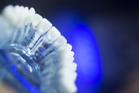 Dental teeth orthodontic dentistry teachng model with gums, tooth enamel, plaque, roots and metal implants.の写真素材