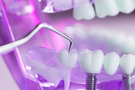 Dental teeth, mouth, gums dentists teaching model showing each tooth and roots toothpick cleaning.の写真素材