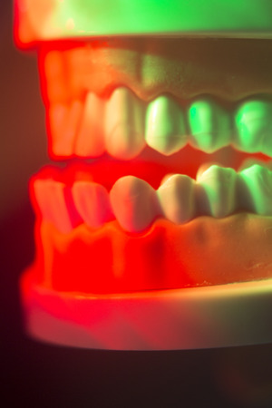 Dental teeth orthodontic dentistry teachng model with gums, tooth enamel, roots and jaw.の写真素材