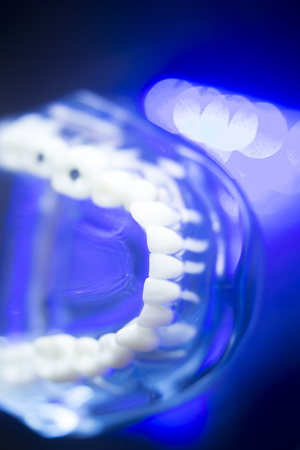 Dental teeth orthodontic dentistry teachng model with gums, tooth enamel, plaque and decay.の写真素材