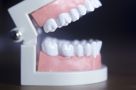 Dental teeth orthodontic dentistry teachng model with gums, tooth enamel, plaque, roots and metal implants.の写真素材