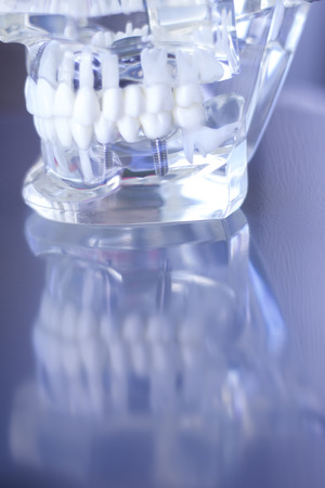 Dentsts dental prosthetic teeth, gums, jaw teaching student model.の写真素材