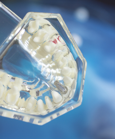 Dental teeth mouth dentists teaching model with teeth, gums, molars and wisdom tooth.