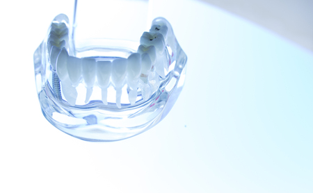 Dental teeth mouth dentists teaching model with teeth, gums, molars and wisdom tooth.