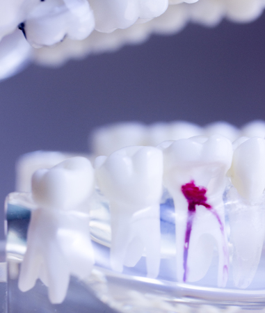 Dental teeth mouth dentists teaching model with teeth, gums, molars and wisdom tooth.の写真素材