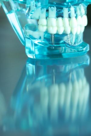 Dentsts dental prosthetic teeth, gums, jaw teaching student model.の写真素材