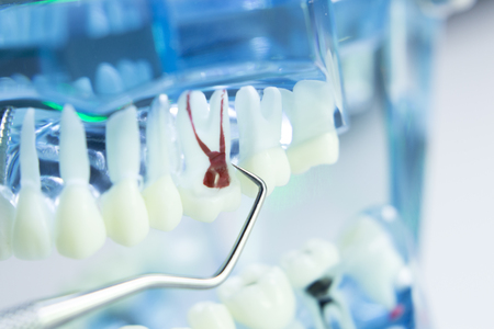 Dental teeth, mouth, gums dentists teaching model showing each tooth and roots toothpick cleaning.の写真素材