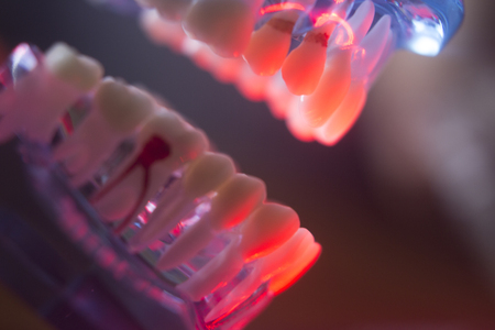 Dental teeth orthodontic dentistry teachng model with gums, tooth enamel, roots and jaw.の写真素材