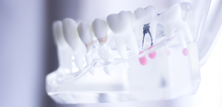 Dental teeth mouth dentists teaching model with teeth, gums, molars and wisdom tooth.の写真素材