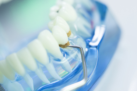 Dental teeth, mouth, gums dentists teaching model showing each tooth and roots.