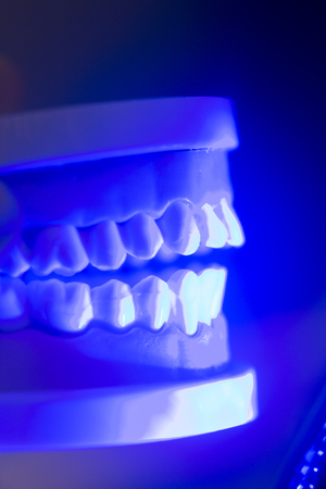 Dental teeth orthodontic dentistry teachng model with gums, tooth enamel, roots and jaw.の写真素材