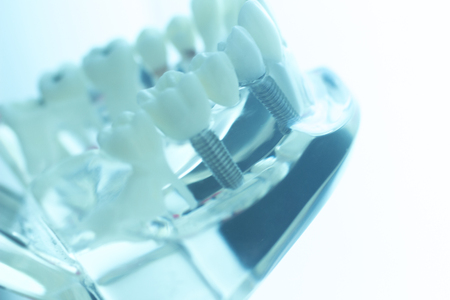 Dental teeth mouth dentists teaching model with teeth, gums, molars and wisdom tooth.