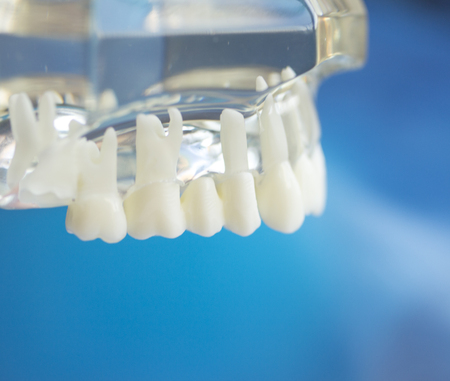 Dental teeth mouth dentists teaching model with teeth, gums, molars and wisdom tooth.
