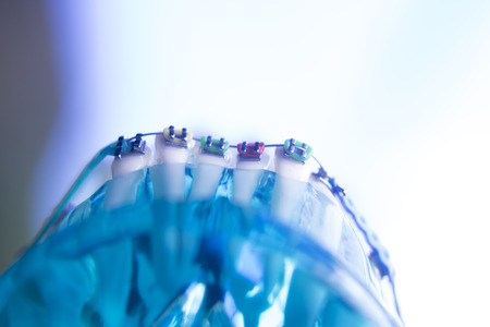 Dental teeth retainers metal aligners brackets to straighten teeth in orthodontic dentistry treatments.の写真素材