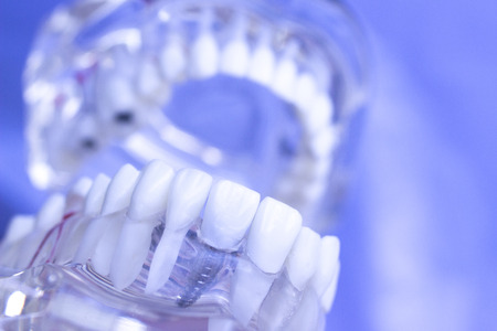 Dental teeth mouth dentists teaching model with teeth, gums, molars and wisdom tooth.の写真素材