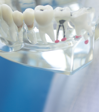 Dental teeth mouth dentists teaching model with teeth, gums, molars and wisdom tooth.の写真素材