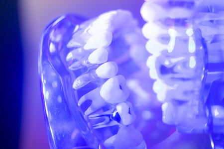 Dental teeth orthodontic dentistry teachng model with gums, tooth enamel, plaque, roots and jaw.