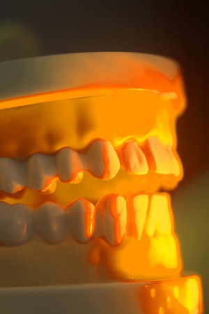 Dental teeth orthodontic dentistry teachng model with gums, tooth enamel, roots and jaw.
