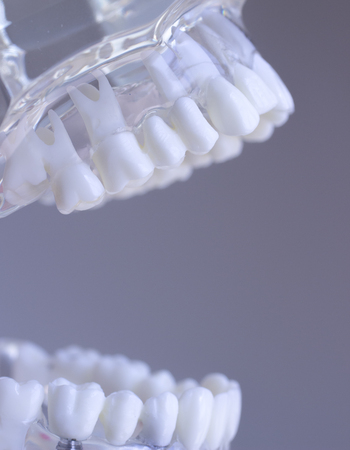 Dental teeth mouth dentists teaching model with teeth, gums, molars and wisdom tooth.の写真素材