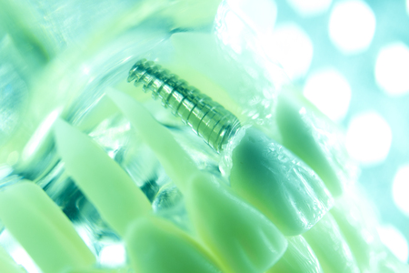 Dental titanium aesthetic orthodontic tooth implant in dentists mouth teeth model closeup isolated.の写真素材