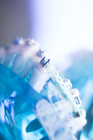 Dental teeth retainers metal aligners brackets to straighten teeth in orthodontic dentistry treatments.の写真素材