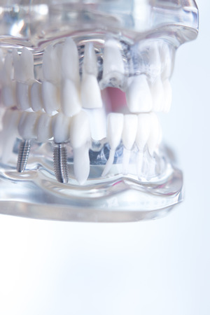 Dentsts dental prosthetic teeth, gums, roots teaching student model with gap in front teeth.の写真素材