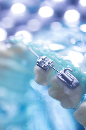 Dental teeth retainers metal aligners brackets to straighten teeth in orthodontic dentistry treatments.の写真素材