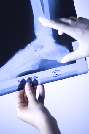 Medical hospital x-ray feet traumatology scan.の写真素材