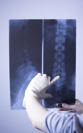Medical hospital x-ray lowe back pain spine and hips traumatology scan.の写真素材